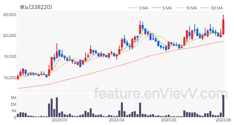 [특징주 분석] 뷰노 주가 차트 (2023.06.02)